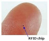 Čip RFID na špičce prstu